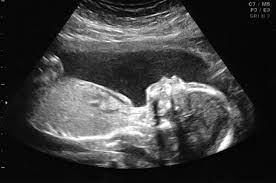 Purchasing fake pregnancy ultrasound and the way to benefit from your web obtain post thumbnail image